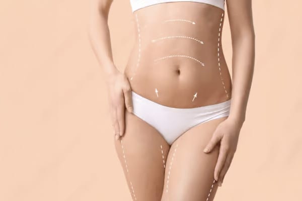 Le taux de mortalité après une abdominoplastie est-il important ?